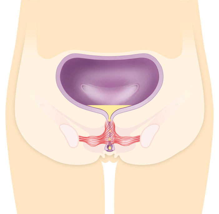 Beckenbodenmuskulatur und Blaseninkontinenz